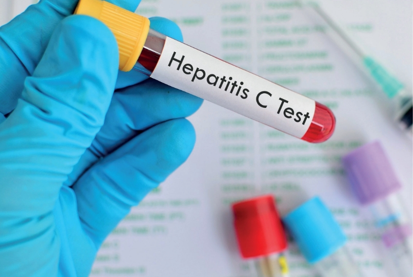 Retos en hepatitis C - FundHepa